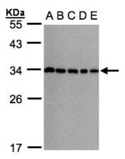 CHMP5 Antibody, Novus Biologicals 0.1mL; Unlabeled:Antibodies, Polyclonal