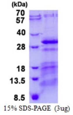 Novus Biologicals&trade;&nbsp;Recombinant Human CHMP5 His Protein