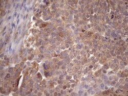 CHMP5 Antibody (OTI5C7), Novus Biologicals 0.1mL; Unlabeled:Antibodies,