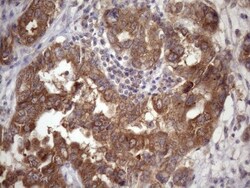 CHMP5 Antibody (OTI5C7), Novus Biologicals 0.1mL; Unlabeled:Antibodies,