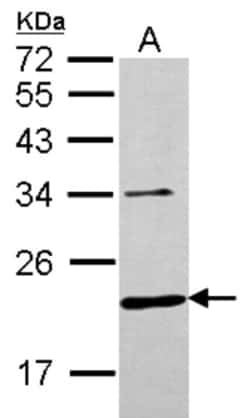 CHMP6 Antibody, Novus Biologicals 0.1mL; Unlabeled:Antibodies, Polyclonal