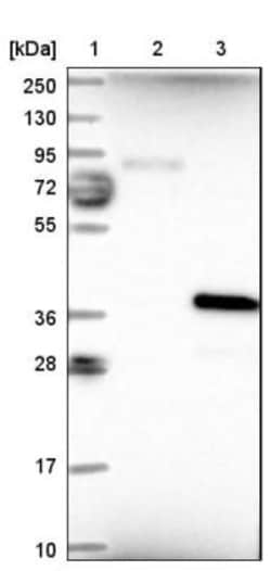 CHMP6 Antibody, Novus Biologicals 0.1mL; Unlabeled:Antibodies, Polyclonal