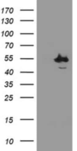 CHN 1 Antibody (OTI2G6), Novus Biologicals 0.1mL; Unlabeled:Antibodies,