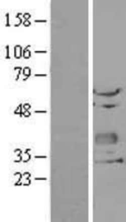 Novus Biologicals&trade;&nbsp;Chondrolectin Overexpression Lysate