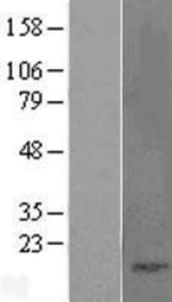 Novus Biologicals&trade;&nbsp;Cholecystokinin Overexpression Lysate