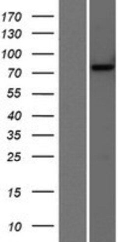 Novus Biologicals&trade;&nbsp;Choline Acetyltransferase/ChAT Overexpression Lysate