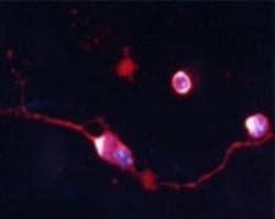 Choline Acetyltransferase/ChAT Antibody, Novus Biologicals 0.025 mL | Buy Online | Novus Biologicals | Fisher Scientific