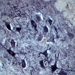 Choline Acetyltransferase/ChAT Antibody, Novus Biologicals 0.025 mL | Buy Online | Novus Biologicals | Fisher Scientific