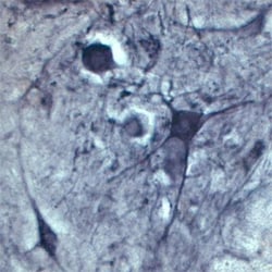 Choline Acetyltransferase/ChAT Antibody, Novus Biologicals 0.025 mL | Buy Online | Novus Biologicals | Fisher Scientific