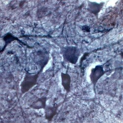 Choline Acetyltransferase/ChAT Antibody, Novus Biologicals 0.025 mL | Buy Online | Novus Biologicals | Fisher Scientific