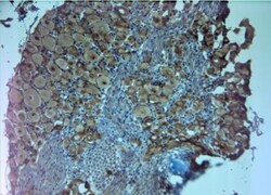 Choline Acetyltransferase/ChAT Antibody, Novus Biologicals 0.025 mL | Buy Online | Novus Biologicals | Fisher Scientific