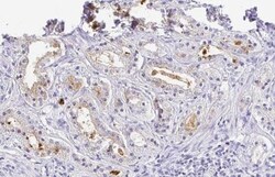 Choline Acetyltransferase/ChAT Antibody, Novus Biologicals 0.1mL; Unlabeled:Antibodies,