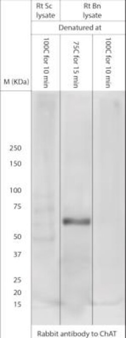 Choline Acetyltransferase/ChAT Antibody, Novus Biologicals 0.025 mL | Buy Online | Novus Biologicals | Fisher Scientific