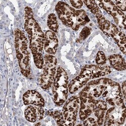 Choline dehydrogenase Antibody, Novus Biologicals:Antibodies:Primary Antibodies