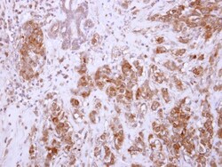 Chondroadherin Antibody, Novus Biologicals 0.1mL; Unlabeled:Antibodies,