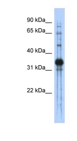 Chondroadherin Antibody, Novus Biologicals 100&mu;L; Unlabeled:Antibodies,