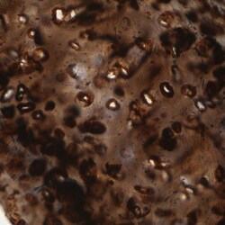 IMP Dehydrogenase 2/IMPDH2 Antibody, Novus Biologicals:Antibodies:Primary