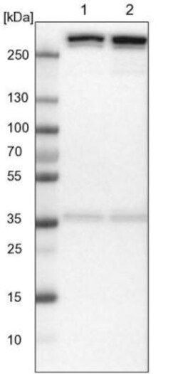 IMP Dehydrogenase 2/IMPDH2 Antibody, Novus Biologicals:Antibodies:Primary