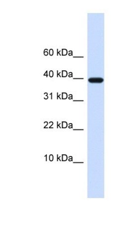 Chondromodulin-1/LECT1 Antibody, Novus Biologicals 0.05mg; Unlabeled:Antibodies,