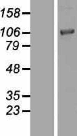 Novus Biologicals&trade;&nbsp;Chordin Overexpression Lysate