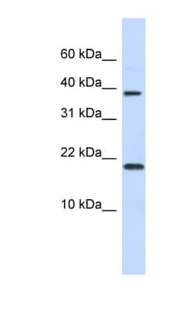 CHRAC1 Antibody, Novus Biologicals 100 &mu;L | Buy Online | Novus Biologicals | Fisher Scientific