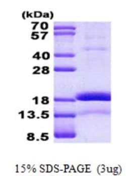 Novus Biologicals&trade;&nbsp;Recombinant Human CHRAC1 His Protein