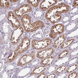 Chordin-like 1/CHRDL1 Antibody, Novus Biologicals 0.1mL; Unlabeled:Antibodies,