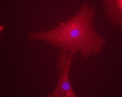CHREBP Antibody, Novus Biologicals 0.1mL; Unlabeled:Antibodies, Polyclonal