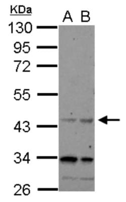 CHRFAM7A Antibody, Novus Biologicals 0.1mL; Unlabeled:Antibodies, Polyclonal