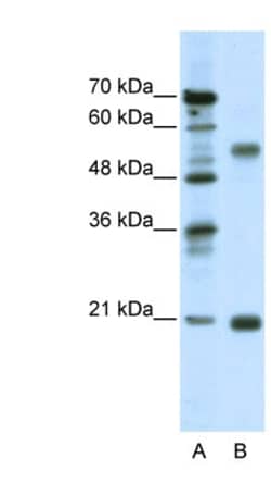 CHRNB3 Antibody, Novus Biologicals:Antibodies:Primary Antibodies