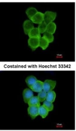 CHRND Antibody, Novus Biologicals 100 &mu;L | Buy Online | Novus Biologicals | Fisher Scientific