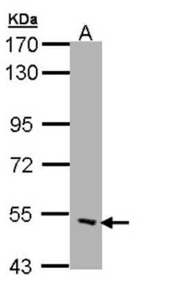 CHRND Antibody, Novus Biologicals 100 &mu;L | Buy Online | Novus Biologicals | Fisher Scientific
