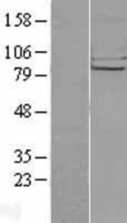 Novus Biologicals&trade;&nbsp;CHSS2 Overexpression Lysate