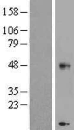 Novus Biologicals&trade;&nbsp;CHST11 Overexpression Lysate