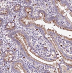 CHST11 Antibody, Novus Biologicals 0.1mL; Unlabeled:Antibodies, Polyclonal