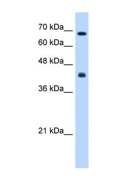CHST8 Antibody, Novus Biologicals 100 &mu;L | Buy Online | Novus Biologicals | Fisher Scientific