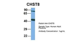 CHST8 Antibody, Novus Biologicals 100 &mu;L | Buy Online | Novus Biologicals | Fisher Scientific