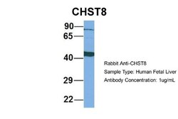 CHST8 Antibody, Novus Biologicals 100 &mu;L | Buy Online | Novus Biologicals | Fisher Scientific