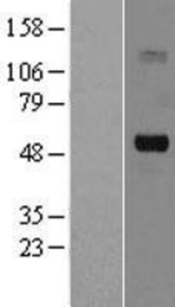 Novus Biologicals&trade;&nbsp;CHT1 Overexpression Lysate