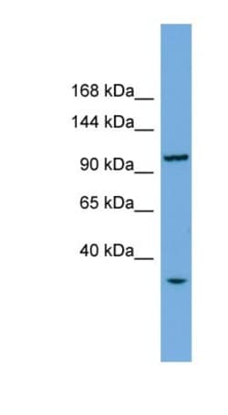CHTF18 Antibody, Novus Biologicals:Antibodies:Primary Antibodies