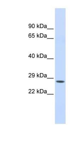 Chymotrypsin C/CTRC Antibody, Novus Biologicals:Antibodies:Primary Antibodies