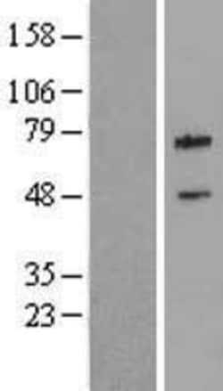 Novus Biologicals™ cIAP-2/HIAP-1 Overexpression Lysate