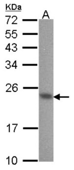 CIB1 Antibody, Novus Biologicals 0.1mg; Unlabeled:Antibodies, Polyclonal
