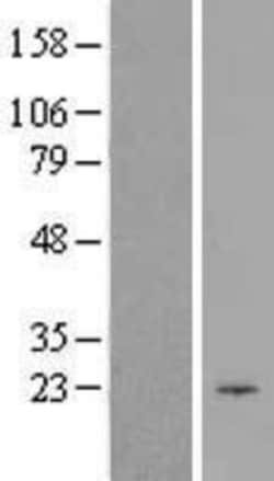 Novus Biologicals&trade;&nbsp;CIB1 Overexpression Lysate