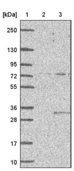 CIB2 Antibody, Novus Biologicals 0.1mL; Unlabeled:Antibodies, Polyclonal