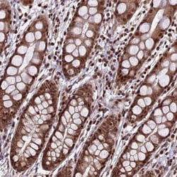 CIB3 Antibody, Novus Biologicals 0.1mL; Unlabeled:Antibodies, Polyclonal