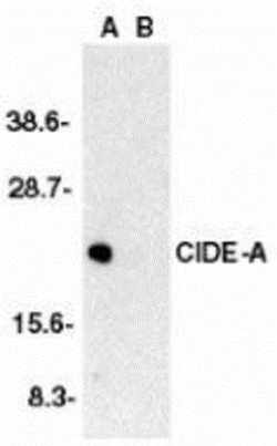 CIDEA Antibody, Novus Biologicals 0.1 mg | Buy Online | Novus Biologicals | Fisher Scientific