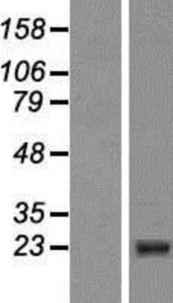 Novus Biologicals&trade;&nbsp;CIDEB Overexpression Lysate