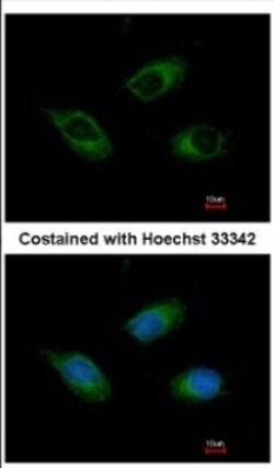 CIDEC Antibody, Novus Biologicals 0.1mL; Unlabeled:Antibodies, Polyclonal