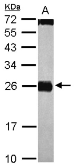 CIDEC Antibody, Novus Biologicals 0.1mL; Unlabeled:Antibodies, Polyclonal